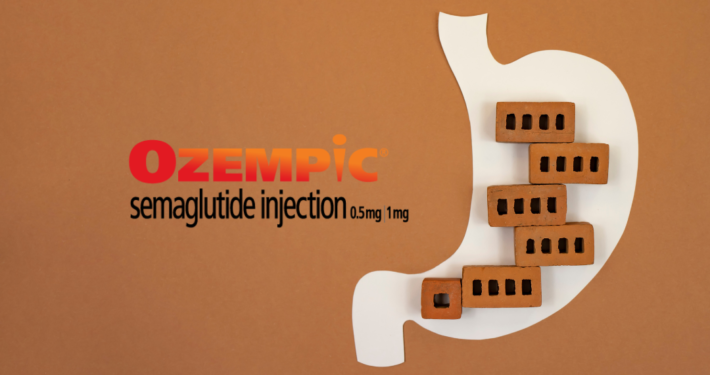 tramadol and semaglutide Can I take painkillers while on Wegovy?