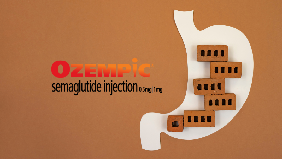 tirzepatide 2.0 How Tirzepatide Affects Your Digestive System