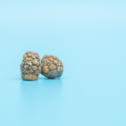 can tirzepatide cause gallstones Can you take Mounjaro with gallstones?