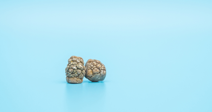 tirzepatide weight loss fort myers FORT MYERS HEALTH & WELLNESS CLINIC - Updated May 2026 - 12581 New Brittany  Blvd, Fort Myers, Florida - Weight Loss Centers - Phone Number