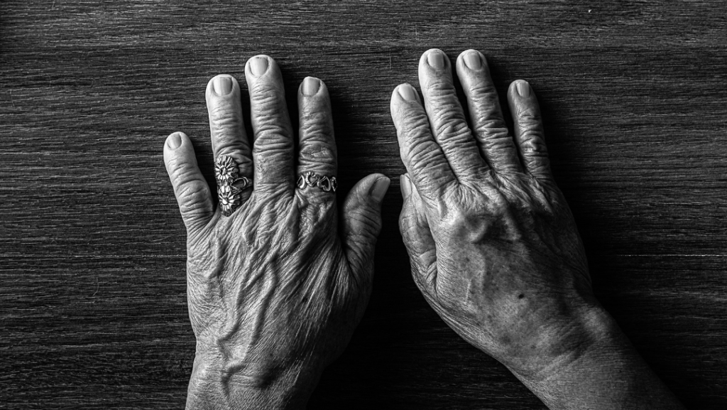 semaglutide and rheumatoid arthritis reddit Can you take Wegovy with rheumatoid arthritis?